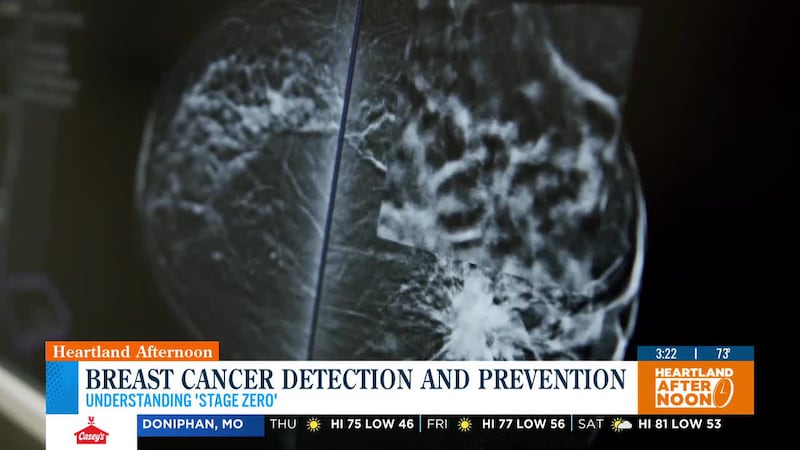 El cáncer de mama es un diagnóstico que ni usted ni sus seres queridos quieren escuchar nunca,...